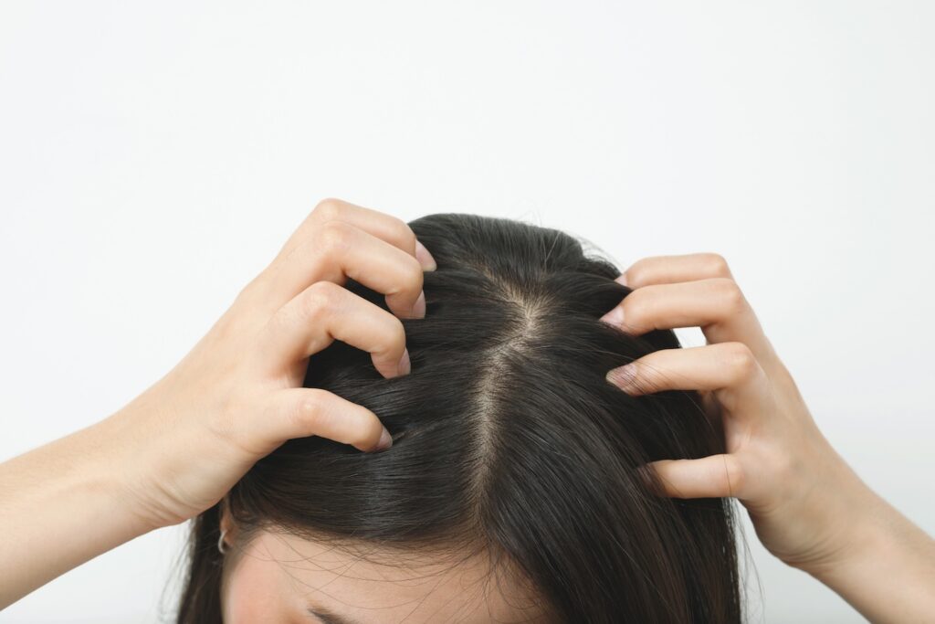 a woman who suffers from eczema, scratching her head wondering about the best eczema treatment for the scalp