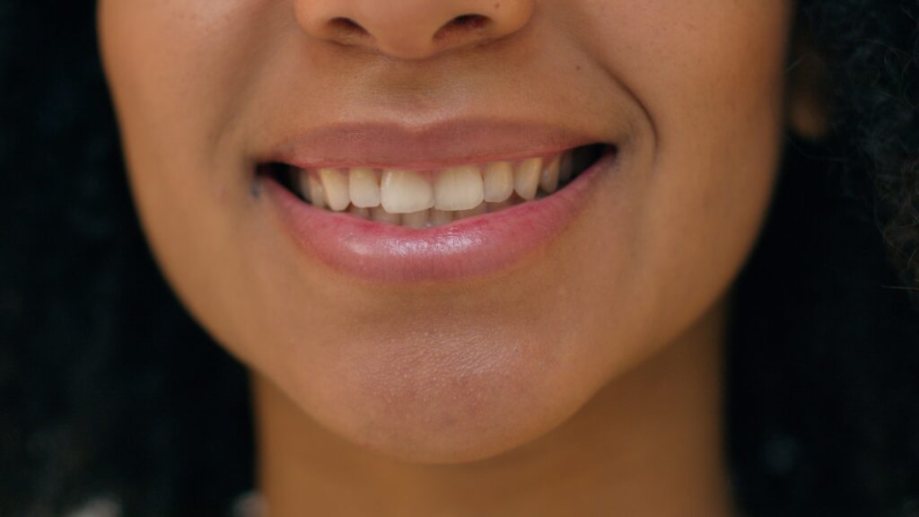 A close-up of a woman smiling because she has discovered the best toothpaste for receding gums